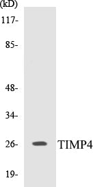 Western blot analysis of extracts from NIH-3T3 cells, using TIMP4 Antibody.