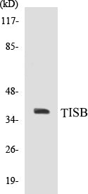 Western blot analysis of extracts from Jurkat/HeLa/A549/LOVO cells, using TISB (Ab-92) Antibody.