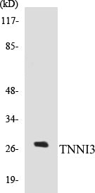Western blot analysis of extracts from mouse heart cells, using TNNI3 (Ab-22/23) Antibody.