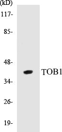 Western blot analysis of extracts from HT-29 cells, treated with serum 20% 15', using TOB1 (Ab-164) Antibody.