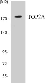 Western blot analysis of extracts from LOVO cells, using TOP2A (Ab-1106) Antibody.