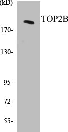 Western blot analysis of extracts from Jurkat cells, using TOP2B Antibody.
