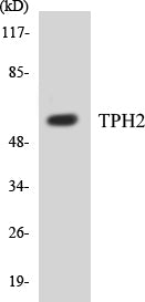 Western blot analysis of the lysates from HUVECcells using TPH2 antibody.