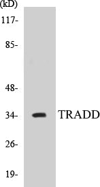 Western blot analysis of extracts from COS7 cells, using TRADD Antibody.