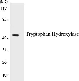 Western blot analysis of extracts from HepG2 cells, using Tryptophan Hydroxylase (Ab-58) Antibody.