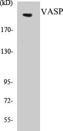 Western blot analysis of extracts from 293 cells, treated with Anisomycin 25ug/ml 30', using Tuberin/TSC2 (Ab-939) Antibody.