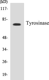 Western blot analysis of extracts from COS7 cells, treated with UV 30', using Tyrosinase Antibody.