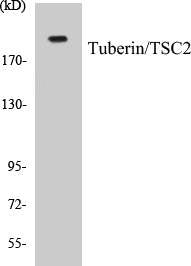 Western blot analysis of extracts from HeLa/COS7 cells, using VASP (Ab-238) Antibody. The lane on the right is treated with the synthesized peptide.