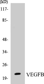 Western blot analysis of extracts from Jurkat cells, using VEGFB Antibody.