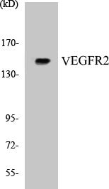 Western blot analysis of extracts from 293 cells, treated with LPS 100ng/ml 30', using VEGFR2 (Ab-1214) Antibody.