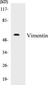 Western blot analysis of extracts from A549 cells, treated with Nocodazole 1ug/ml 16h, using Vimentin (Ab-56) Antibody.