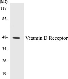 Western blot analysis of extracts from MCF-7 cells, using Vitamin D Receptor (Ab-208) Antibody.