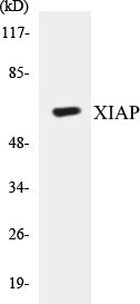 Western blot analysis of extracts from 293 cells, using XIAP (Ab-87) Antibody.