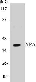 Western blot analysis of extracts from COLO205 cells, using XPA Antibody.