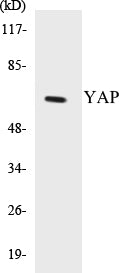 Western blot analysis of extracts from HepG2 cells, treated with Wortmannin 40nM 24h, using YAP (Ab-127) Antibody.