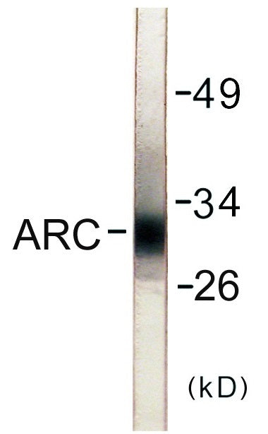 Western blot analysis of extracts from HeLa cells, using ARC Antibody. The lane on the right is treated with the synthesized peptide.