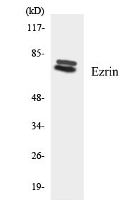 Western blot analysis of extracts from HeLa/HepG2/K562, using Ezrin Antibody. The lane on the right is treated with the synthesized peptide.
