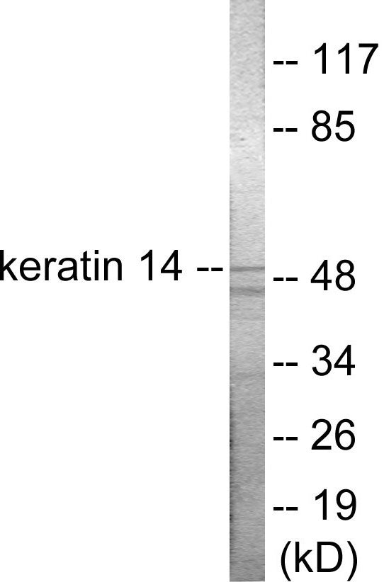 Western blot analysis of extracts from NIH-3T3 cells, using Keratin 14 Antibody.
