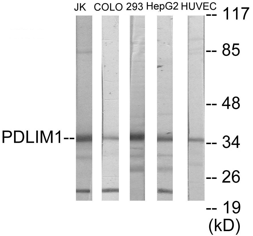 Western blot analysis of extracts from Jurkat/COLO205/293/HepG2/HuvEc cells, using PDLIM1 Antibody.