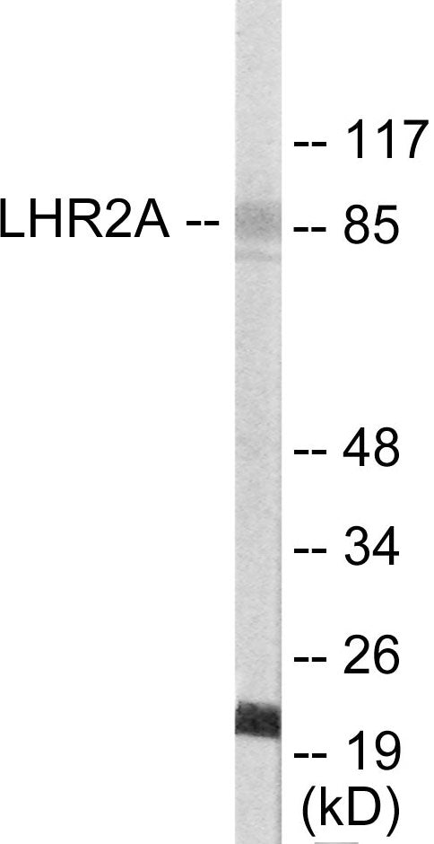 Western blot analysis of extracts from 293 cells, using LHR2A Antibody. The lane on the right is treated with the synthesized peptide.