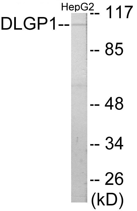 Western blot analysis of extracts from HepG2 cells, using DLGP1 Antibody.