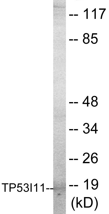 Western blot analysis of extracts from HuvEc cells, using TP53I11 Antibody.