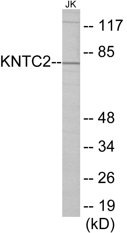 Western blot analysis of extracts from Jurkat cells, using KNTC2 Antibody.