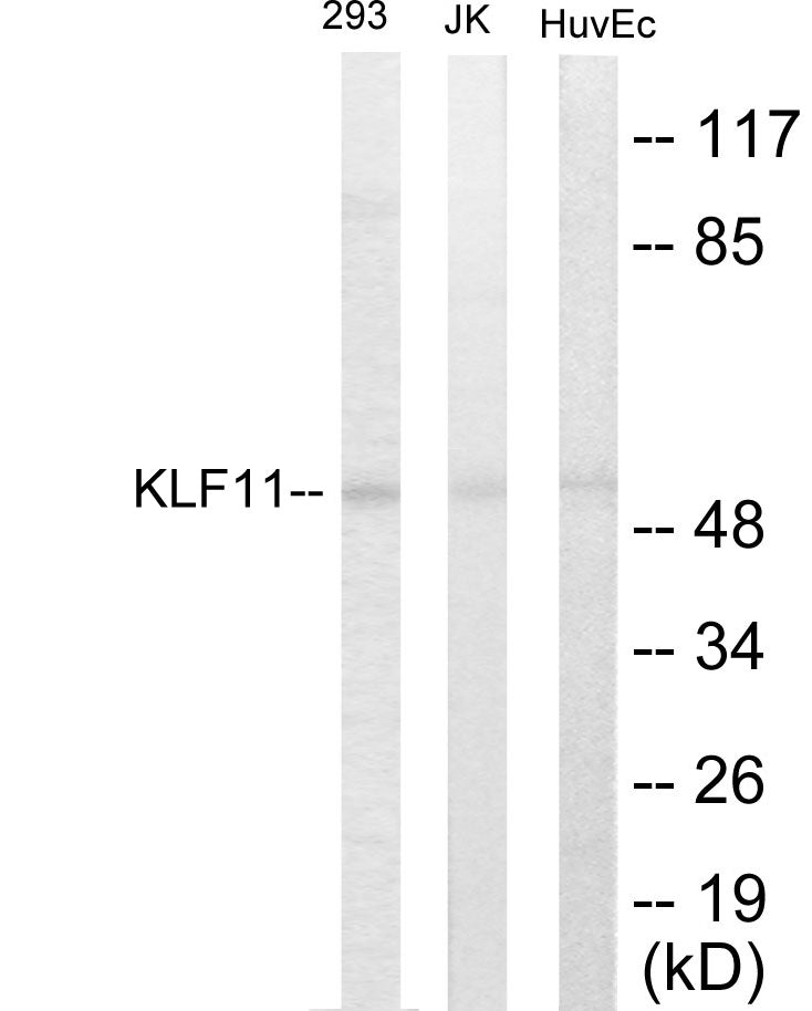 Western blot analysis of extracts from 293/Jurkat/HuvEc cells, using KLF11 Antibody. The lane on the right is treated with the synthesized peptide.