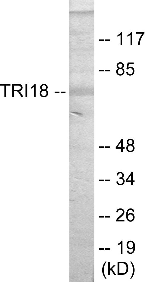 Western blot analysis of extracts from 293 cells, using TRI18 Antibody.