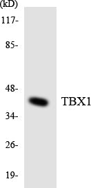 Western blot analysis of extracts from COLO205 cells, using TBX1 Antibody.