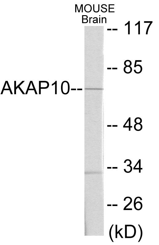 Western blot analysis of extracts from mouse brain cells, using AKAP10 Antibody. The lane on the right is treated with the synthesized peptide.