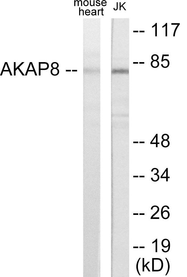 Western blot analysis of extracts from mouse heart/Jurkat cells, using AKAP8 Antibody.