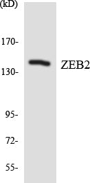 Western blot analysis of extracts from Jurkat cells, using ZEB2 Antibody.
