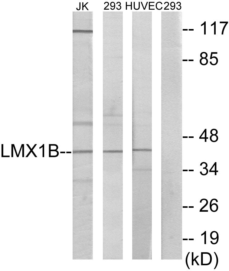 Western blot analysis of extracts from Jurkat/293/HuvEc cells, using LMX1B Antibody. The lane on the right is treated with the synthesized peptide.