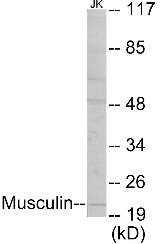 Western blot analysis of extracts from Jurkat cells, using Musculin Antibody.