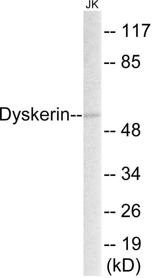 Western blot analysis of extracts from JurKat cells, using Dyskerin Antibody.