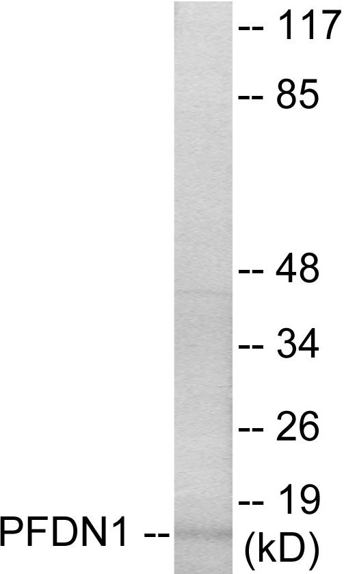 Western blot analysis of extracts from RAW264.7 cells, using PFDN1 Antibody. The lane on the right is treated with the synthesized peptide.