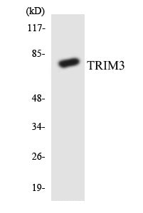 Western blot analysis of extracts from COLO cells, using TRIM3 Antibody.