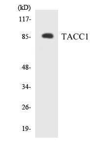 Western blot analysis of extracts from K562 cells, using TACC1 Antibody.