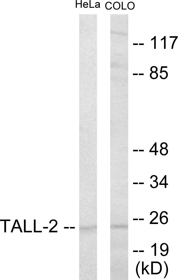Western blot analysis of extracts from HeLa/COLO205 cells, using TALL-2 Antibody.
