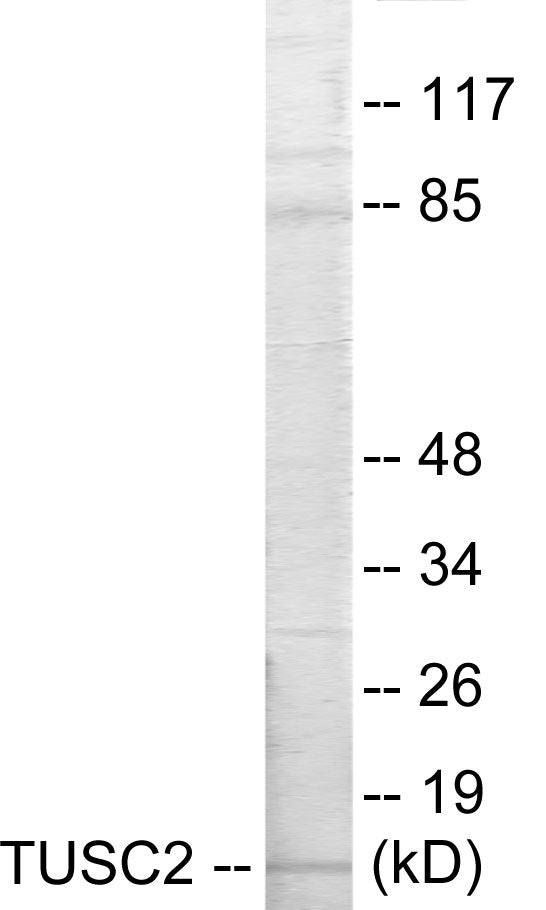 Western blot analysis of extracts from HeLa cells, using TUSC2 Antibody. The lane on the right is treated with the synthesized peptide.