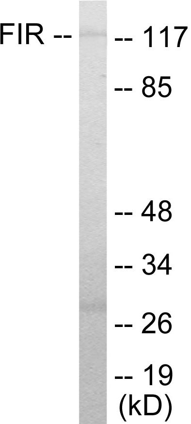 Western blot analysis of extracts from HuvEc cells, using FIR Antibody. The lane on the right is treated with the synthesized peptide.