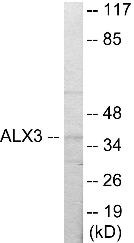 Western blot analysis of extracts from 293 cells, using ALX3 Antibody.