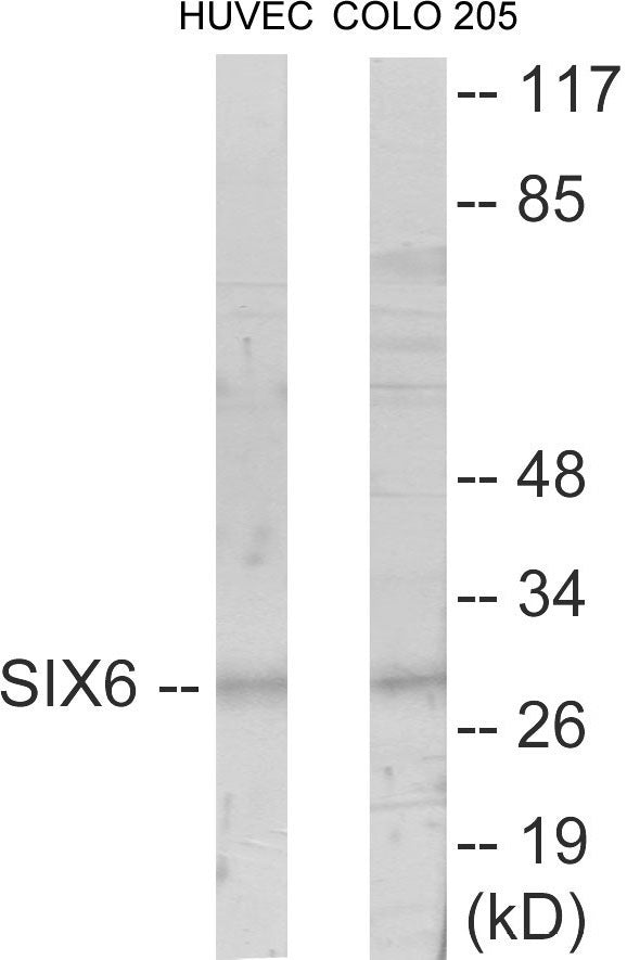 Western blot analysis of extracts from HuvEc/COLO205 cells, using SIX6 Antibody.
