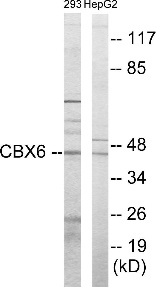 Western blot analysis of extracts from 293/HepG2 cells, using CBX6 Antibody. The lane on the right is treated with the synthesized peptide.