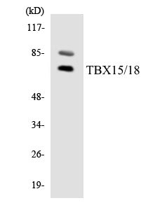 Western blot analysis of extracts from HuvEc/HeLa/Jurkat cells, using TBX15/18 Antibody.