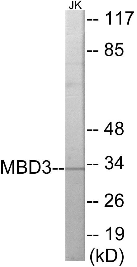 Western blot analysis of extracts from Jurkat cells, using MBD3 Antibody. The lane on the right is treated with the synthesized peptide.