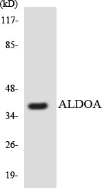 Western blot analysis of extracts from A549/HeLa/HT-29 cells, using ALDOA Antibody. The lane on the right is treated with the synthesized peptide.