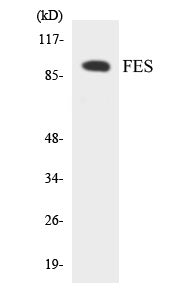 Western blot analysis of extracts from HuvEc cells, treated with serum 20% 30', using FES Antibody. The lane on the right is treated with the synthesized peptide.