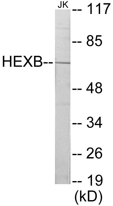 Western blot analysis of extracts from Jurkat cells, using HEXB Antibody.